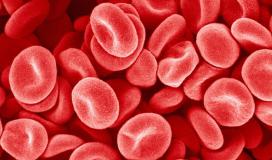 دراسة تكشف فصيلة الدم التي تتنبأ بخطر الإصابة بمرض فيروسي يصيب الأطفال